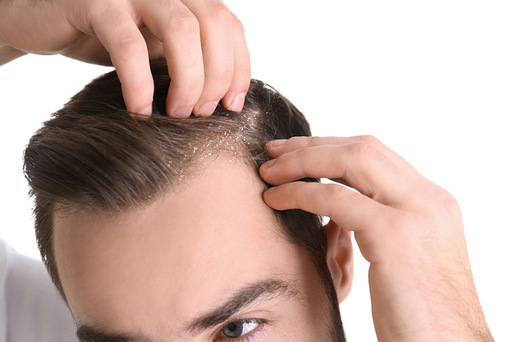 PRP Hair Therapy in Dubai.jpg