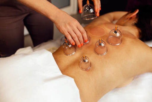 Is Hijama Cupping Therapy Effective for Fibromyalg