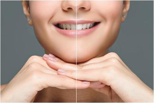 Teeth Whitening for Busy People Quick Fixes for a