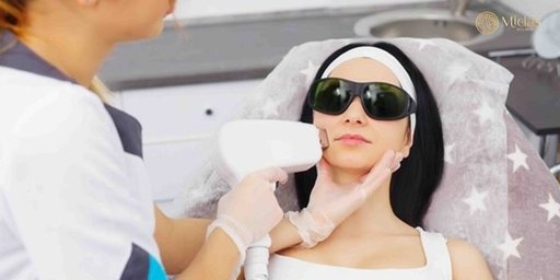 pico laser treatments.jpg