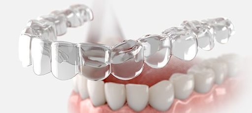 Aligners Made Easy Simplifying the Straightening P