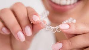 Aligners for Crooked Teeth The Modern Way to Strai