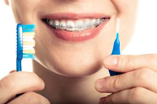 Why Straight Teeth Are About More Than Just Looks.