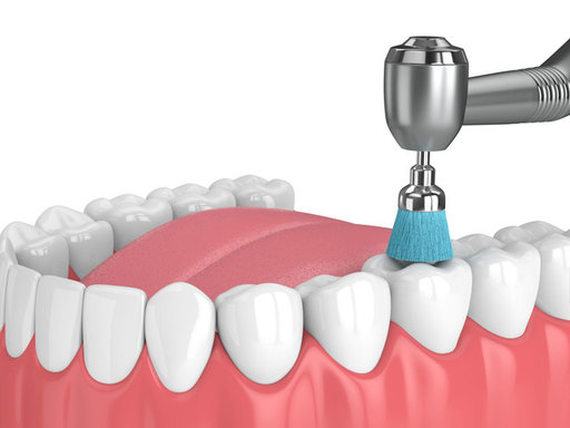 Maintaining a Radiant Smile The Importance of Regu