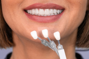 Can Composite Veneers Fix Your Teeth Here's the Tr