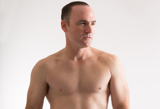 How To Identify Gynecomastia in Adolescents Early.