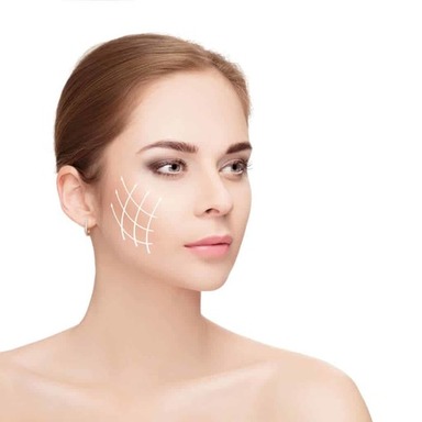 Is Thread Lift Treatment a Good Alternative to Bot
