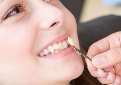 10 Myths About Composite Veneers You Should Stop B