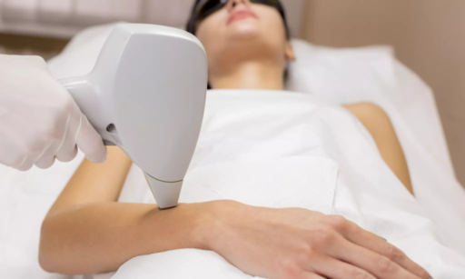 How Does Laser Hair Removal Affect Skin Pigmentati