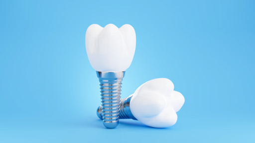How to Maintain Your Dental Implants for Long-Term