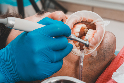Full Mouth Rehabilitation The Key to a Stunning Sm