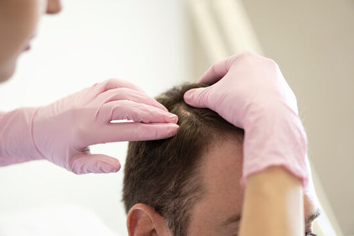 How Does Finasteride For Hair Loss Improve Overall