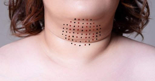 How Effective is Double Chin Liposuction.jpg