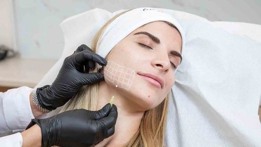 Thread Lift Treatments.jpg