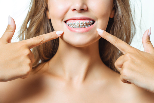 How to Monitor Your Progress During Braces Treatme