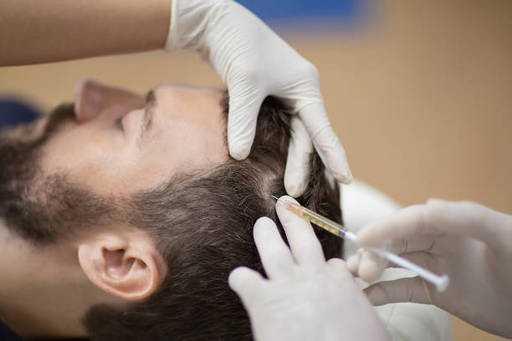 PRP-Hair-Treatment-dubai.jpg