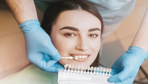 The Future of Smiles A Complete Guide to Non-Prep