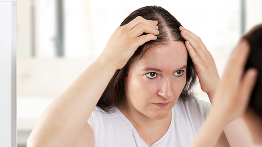 hair_loss_.jpg