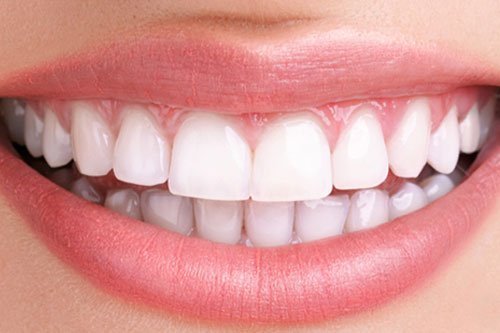 teeth-whitening-blogimg.jpg