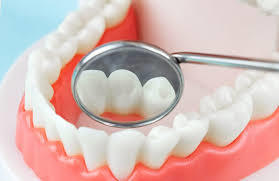 A Complete Guide to Teeth Dentures What You Need t