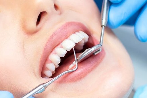 The Importance of a Beautiful Smile in Today’s Pro