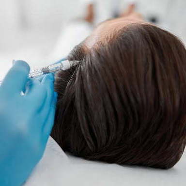 PRP-hair-treatment-.jpg