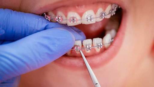 The Future of Orthodontics How Technology is Chang