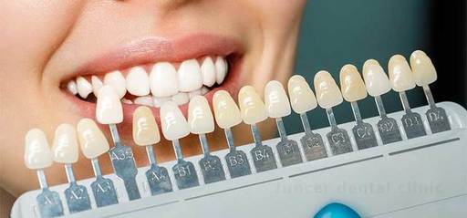 How to Choose the Right Dentist for Your Veneer Tr