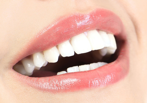 teeth-whitening-dentist-los-banos.jpg