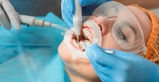 Teeth Cleaning for Seniors Maintaining Oral Health
