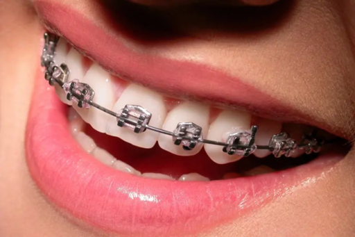 Smile Transformations Inspiring Before-and-After B