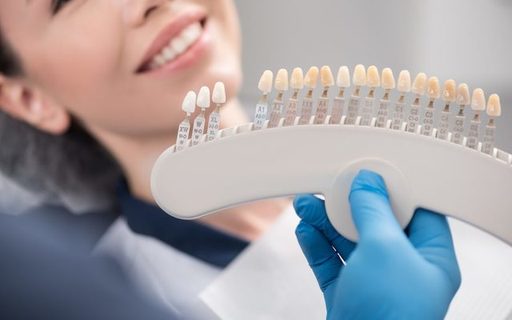 Common Questions About Dental Veneers Answered.jpg