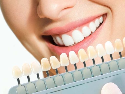 Are Dental Veneers the Right Choice for You Find O