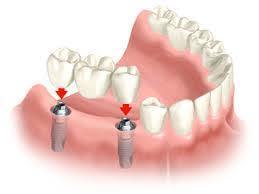 dental clinic dubai (2).jpg